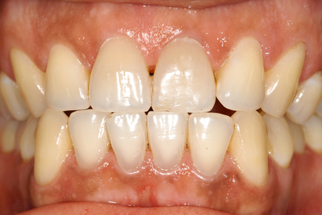 Perio Dentist Hopewell Junction Cosmetic Dentistry Hopewell Junction Periodontal Disease Dentist